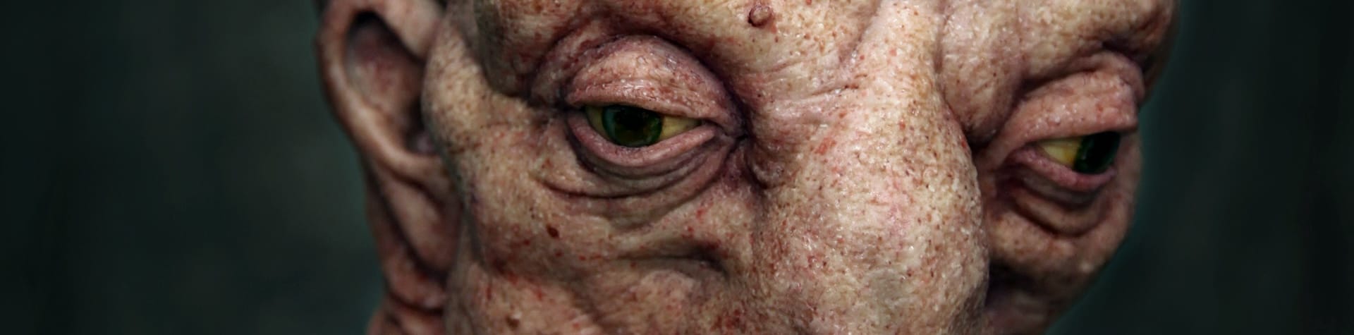prosthetics