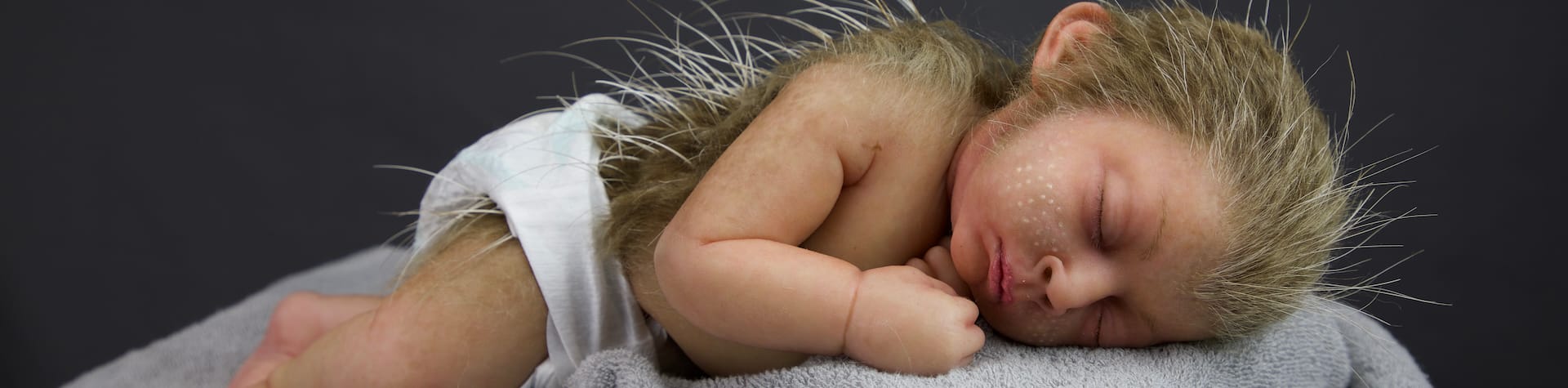 prosthetic baby